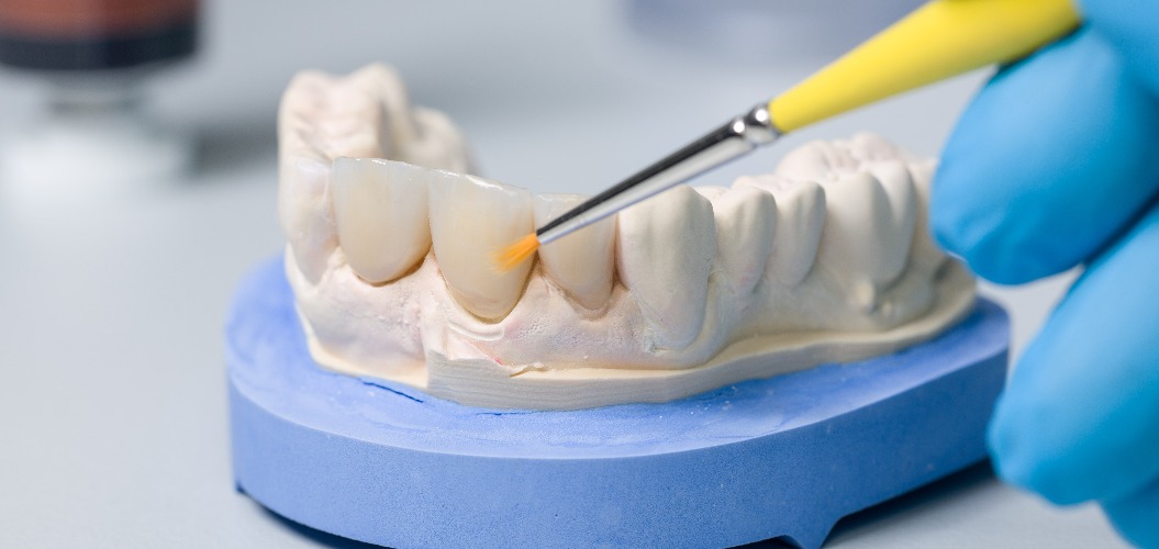 Farbliche Bearbeitung eines Zahnersatzes im Dentallabor