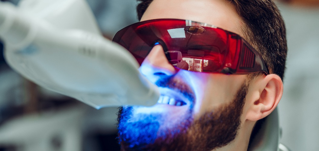 Man having teeth whitening by dental UV whitening device,dental assistant taking care of patient,eyes protected with glasses. Whitening treatment with light, laser, fluoride.